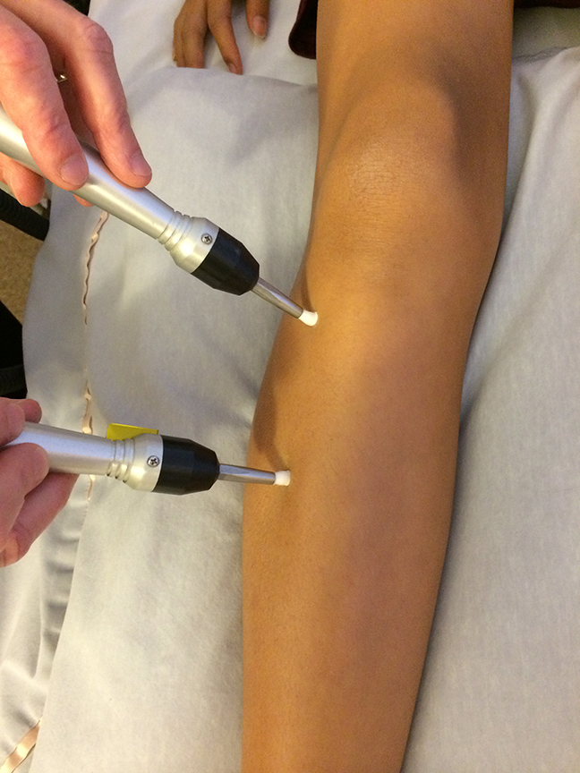 microcurrent-therapy-at-marin-acupuncture-center